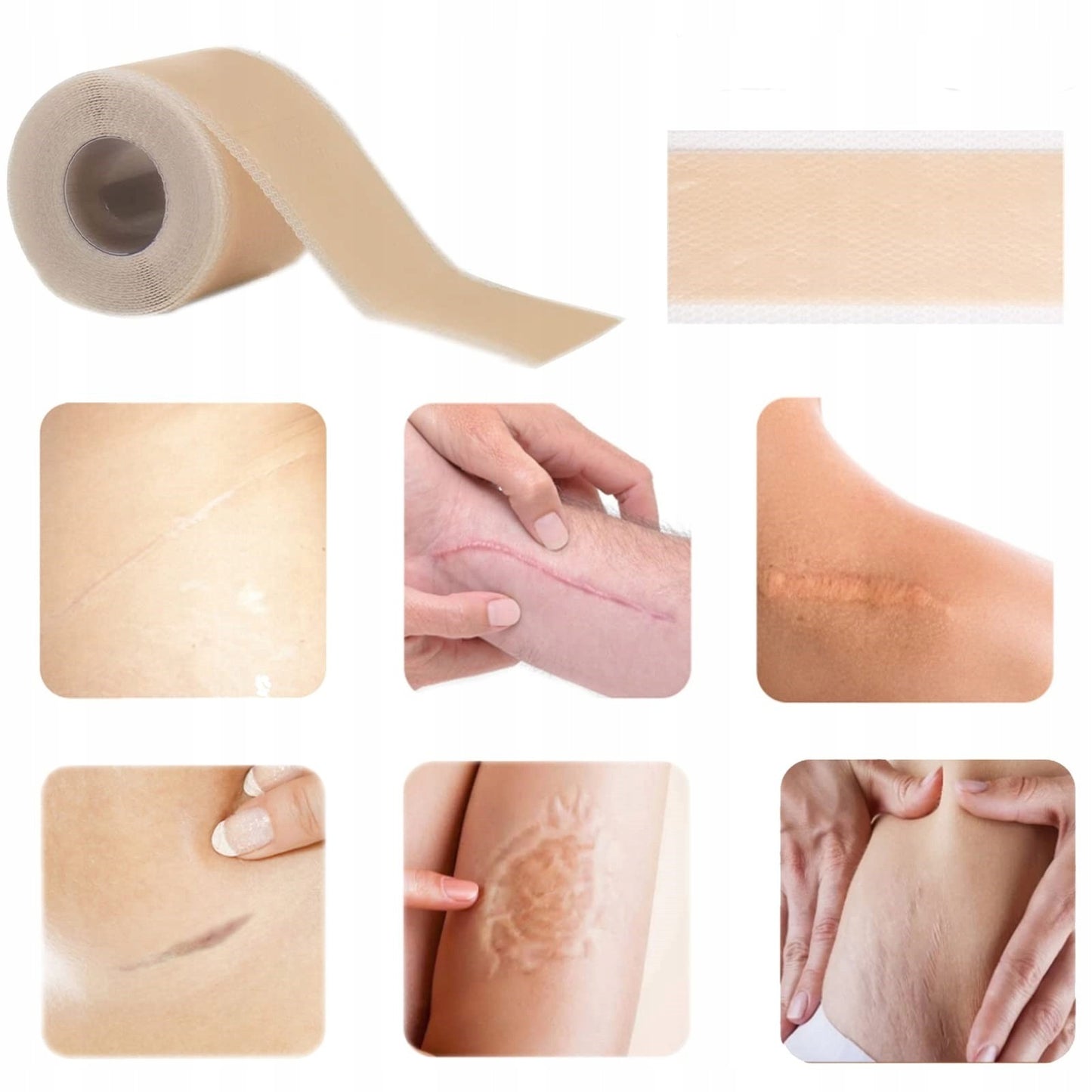 DermaCraft Scar tape