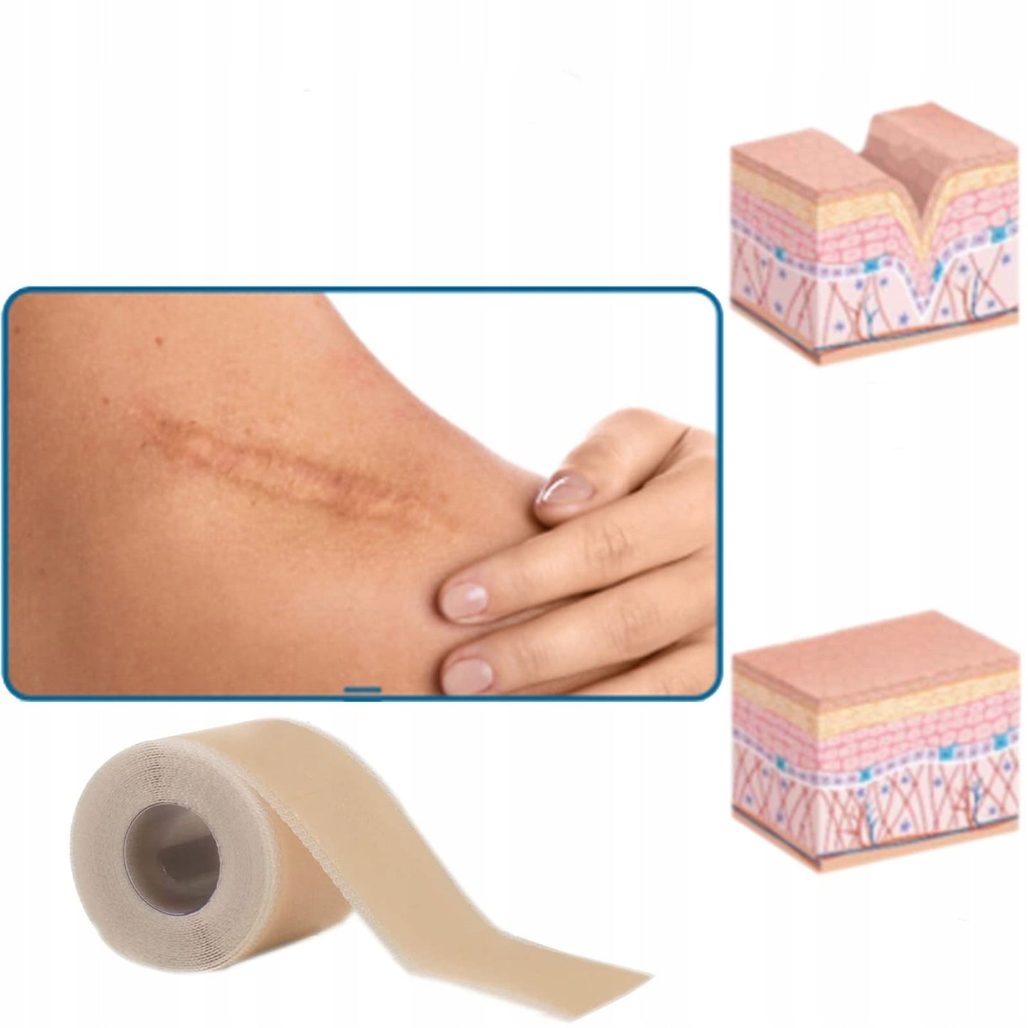 DermaCraft Scar tape